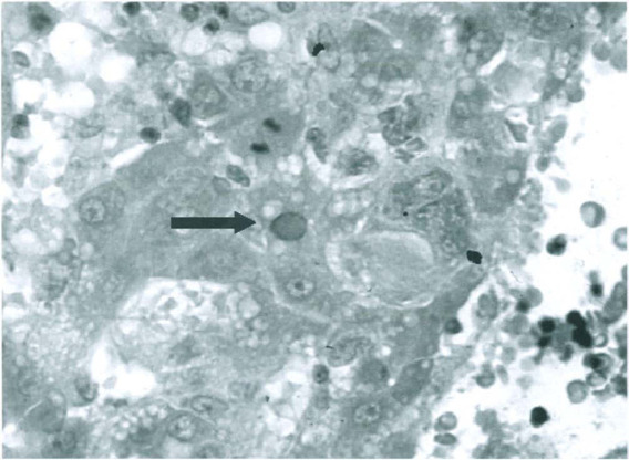 Fig. 12-6