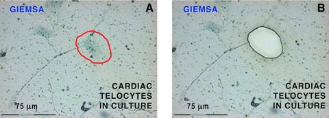 Fig 14