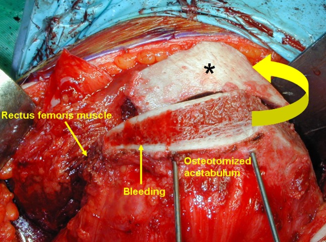 Fig. 4