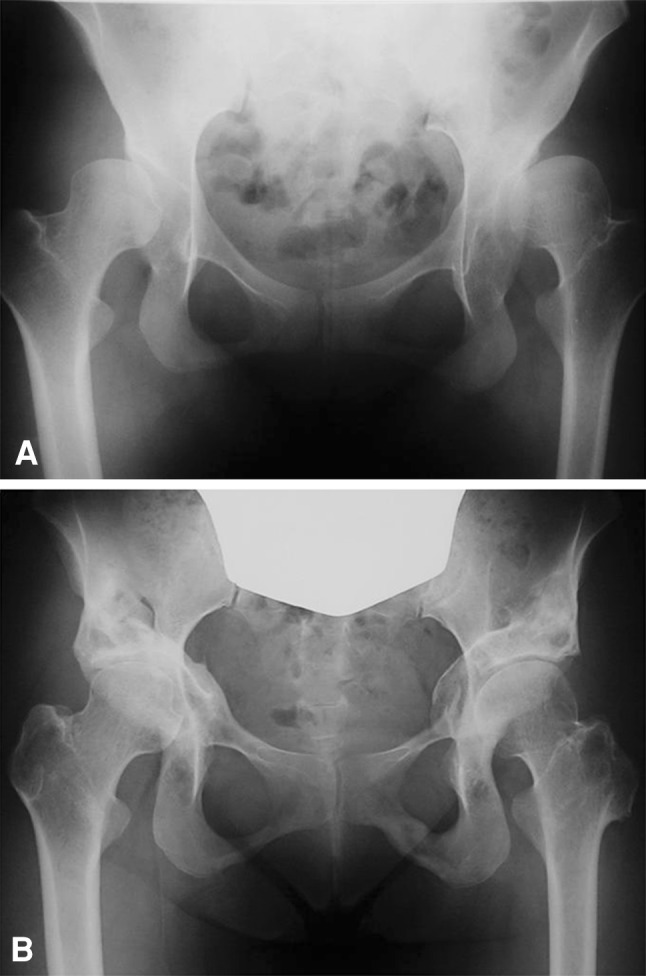 Fig. 6A–B