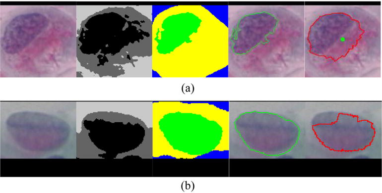 Fig. 11