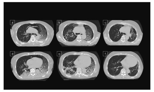 Fig. 5.