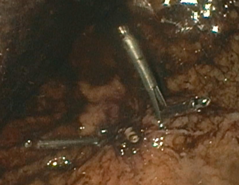 Figure 6