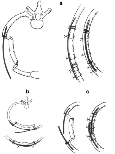 Fig. 12