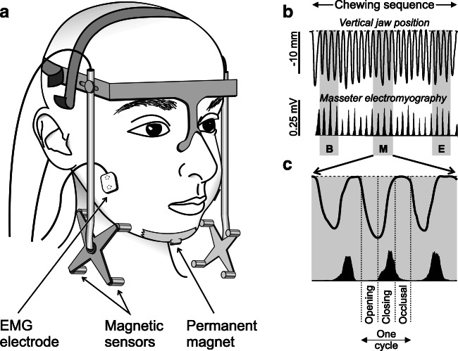 Fig. 1