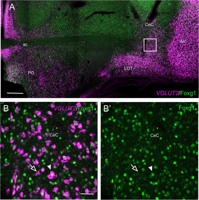 FIGURE 11