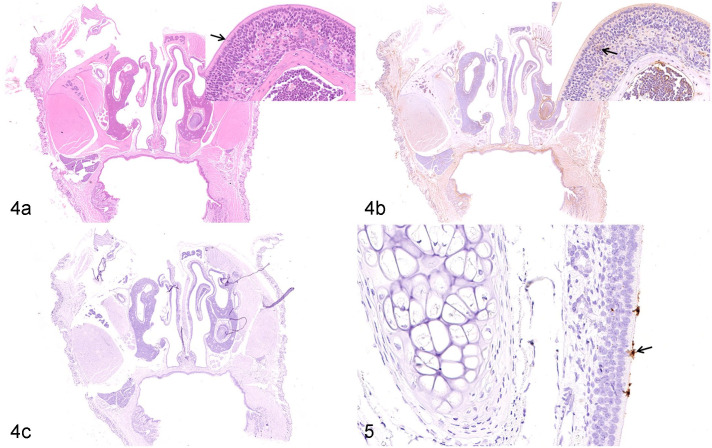 Figures 4 and 5.