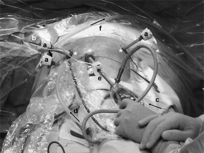 Fig. 2