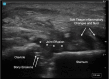 Image 2.