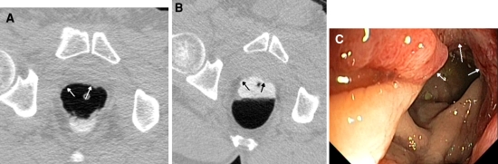 Fig. 1