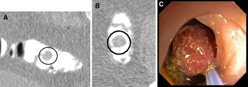 Fig. 2