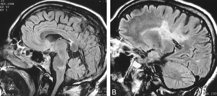 fig 2.