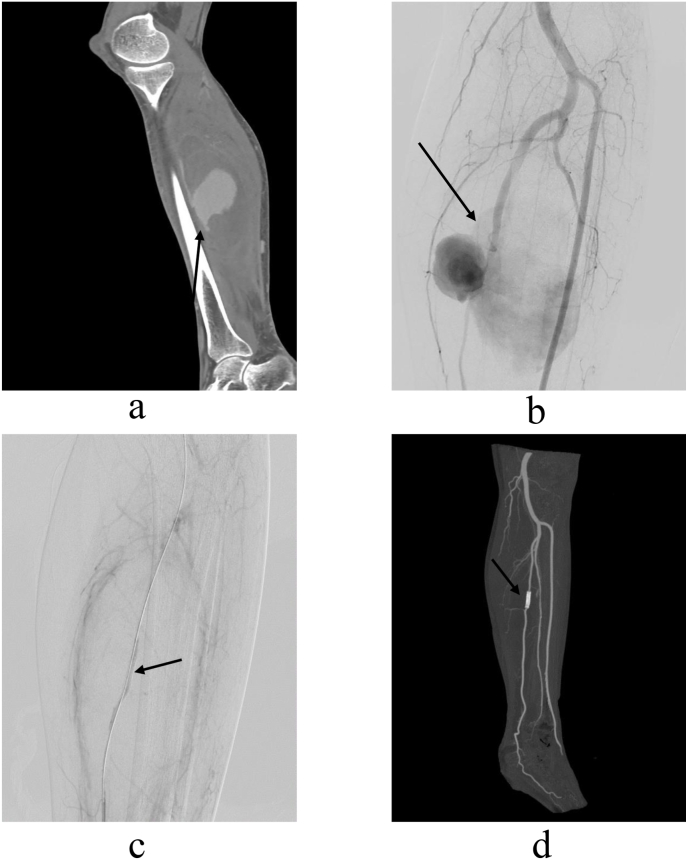 Fig. 3