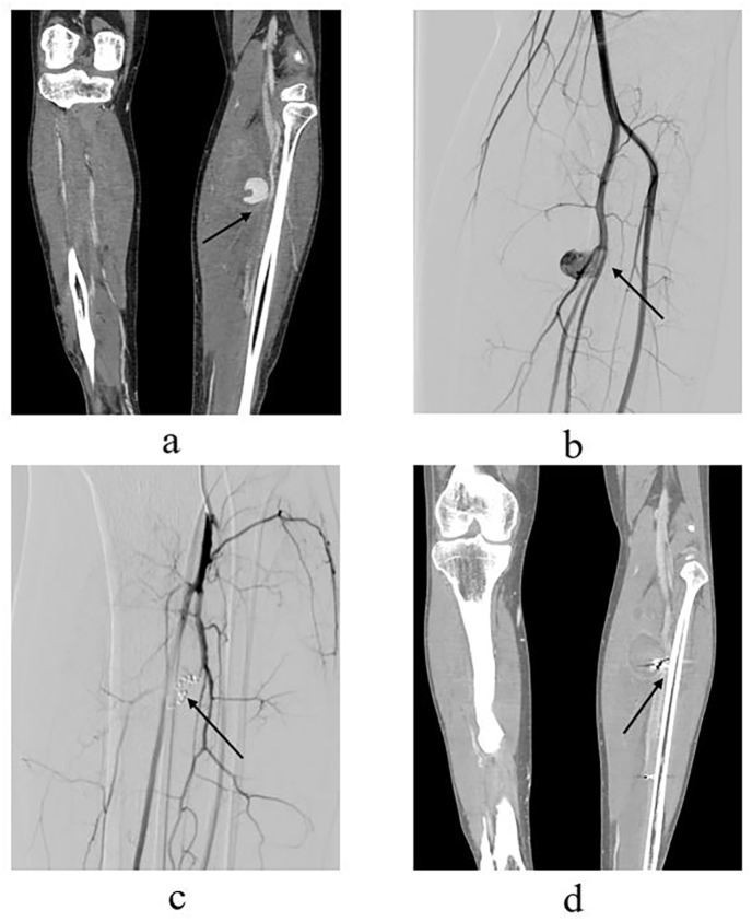 Fig. 2