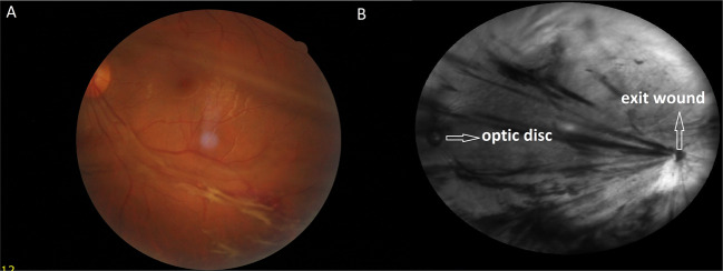 Fig. 1