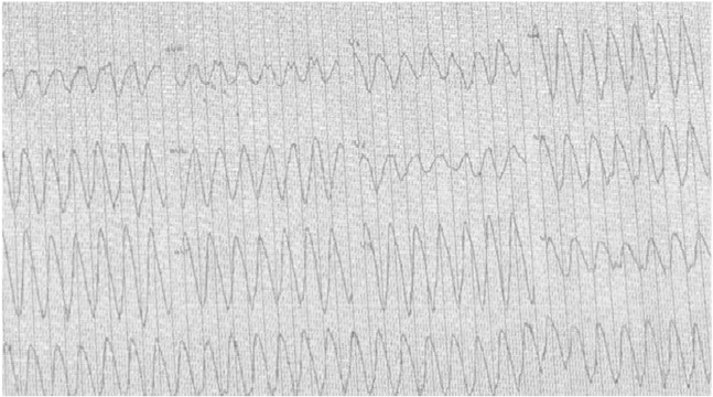 Fig. 1