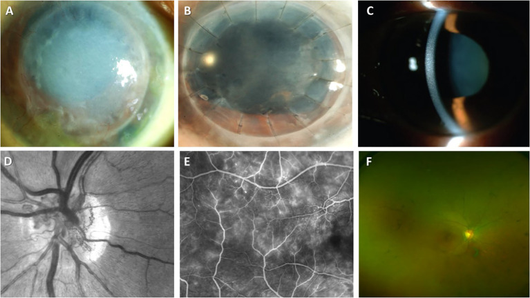 Figure 3