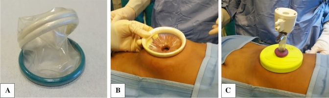Fig. 1