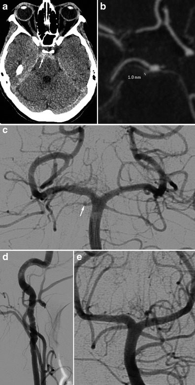 Fig. 11