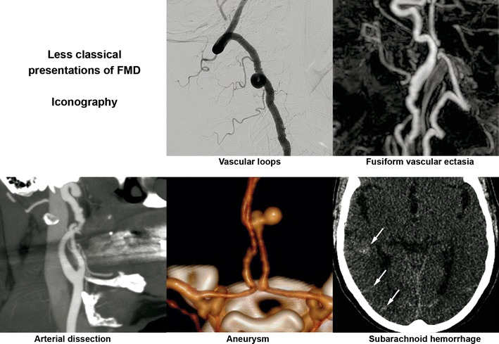 Fig. 12