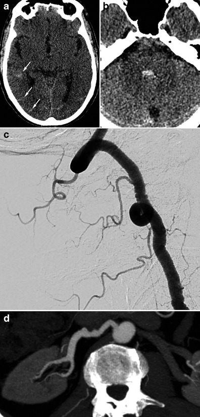 Fig. 10