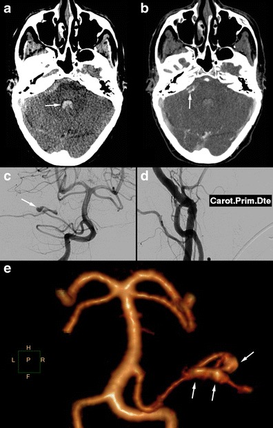 Fig. 9