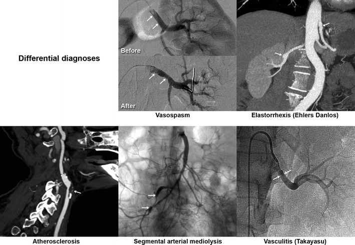 Fig. 13