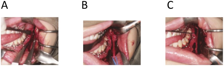 Fig 2