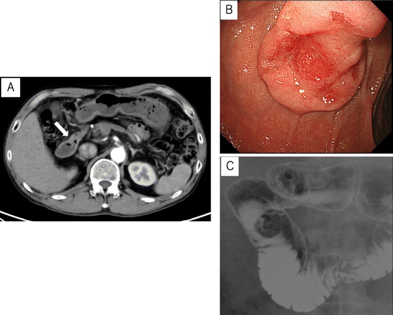 Fig. 1