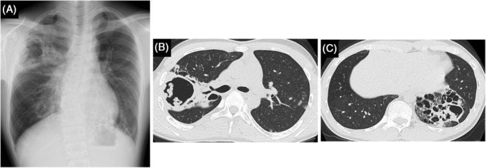 FIGURE 2