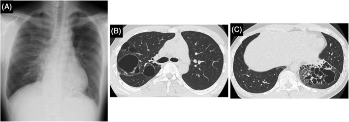 FIGURE 1