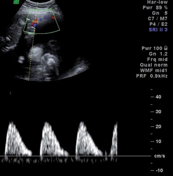 Fig. 2b