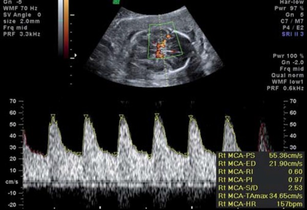 Fig. 3b