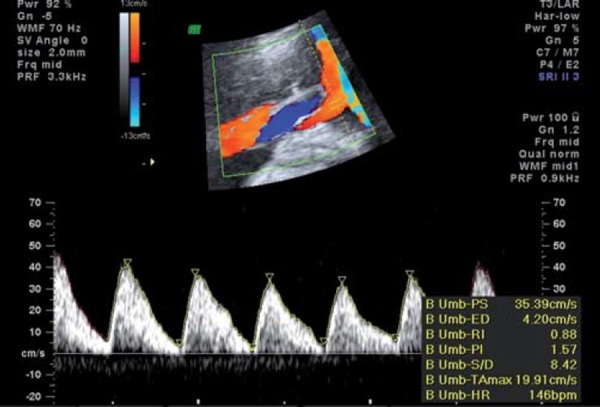 Fig. 2a