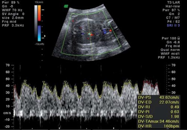 Fig. 4a