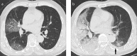 Figure 4. a, b