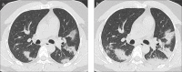 Figure 3. a, b