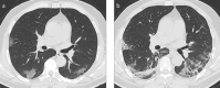 Figure 2. a, b