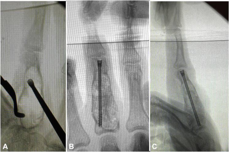 Figure 7