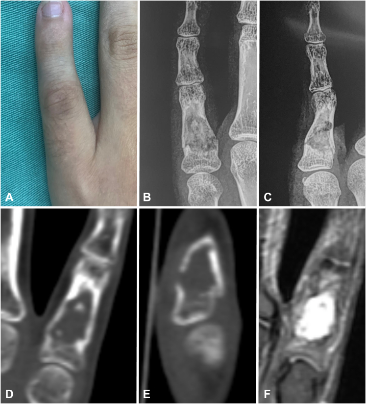 Figure 4
