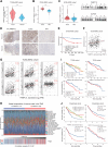 Figure 1. PABPC1L is upregulated in RCC and is correlated with immunosuppression in RCC. A, PABPC1L mRNA levels in RCC tumor tissues and normal tissues from TCGA database. B, Relative RNA expression of PABPC1L in human RCC tumors (T) and matched normal adjacent tissues (NAT) according to qRT-PCR in SYSU-KIRC cohort. C, Representative Western blot (right) and statistical analysis (left) of PABPC1L protein expression levels in SYSU-KIRC cohort. D, Representative IHC images showing the expression of PABPC1L in tumors and matched normal adjacent tissues. E, OS of patients with RCC with low (n = 66) or high (n = 66) PABPC1L expression in SYSU-KIRC cohort. F, TIDE analysis revealed that PABPC1L was positively associated with immune dysfunction score in TCGA-KIRC dataset. G, PABPC1L was positively associated with inhibitory checkpoints, Treg marker and M2 tumor-associated macrophage markers according to TCGA database. H, PABPC1L expression group and proportions of TME cells for 305 patients in TCGA-KIRC cohort and the elevated infiltration level of Tregs upon higher expression of PABPC1L. I, OS of patients with RCC in the TCGA-KIRC cohort, stratified by both PABPC1L expression and Treg infiltration. J, OS of patients with RCC in the Checkmate cohort, stratified by both PABPC1L expression and Treg infiltration. ***, P < 0.001.