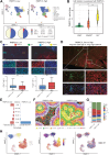 Figure 3. Effect of RCC PABPC1L expression in Tregs infiltration at single-cell resolution and Tregs spatial distribution in the TME. A, Top, UMAP plots of tumor-infiltrating immune cells in tumor tissues with high or low expression of PABPC1L. Bottom, distribution of tumor-infiltrating immune cell clusters across tumor tissues with high or low expression of PABPC1L. B, Cell markers coexpressed with PABPC1L+ cells. C, Multiplex IF detected the infiltration levels of Tregs and CD8+ T cells in tumor tissues from patients with high or low PABPC1L expression. Scale bars, 400 or 60 μm. D, The level of infiltration of CD8+ T in the high expression region of PABPC1L was significantly different from that in the low expression region. Scale bars, 1 mm or 60 μm. E, Statistical analysis of CD8+ T cells spatial distribution in tumor tissues with high and low expression of PABPC1L. F, Representative spatial distribution scatterplots of CD8+ T cells in tumor tissues with high and low expression of PABPC1L. G, Percentage distribution of T-cell clusters in tumor tissues with high or low expression of PABPC1L. H, The potential developmental trajectory of T-cell clusters in TME. Each dot represents a single cell, colored according to clusters (left), pseudotime (middle), or PABPC1L expression group. **, P < 0.01; ***, P < 0.001.