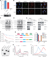 Figure 5. Binding of PABPC1L to JAK2 mRNA promotes its stability and translation. A, RIP assays showed the association of PABPC1L with JAK2 mRNA. Relative enrichment representing RNA levels associated with PABPC1L compared with input control. IgG antibody served as a control. B, IF-FISH assay showing that JAK2 mRNA is colocalized with PABPC1L protein in the cytoplasm. Scale bar, 10 μm. C, Representative Western blot analysis showing the coimmunoprecipitation of overexpressed PABPC1L-Flag and endogenous eIF4G in both 769-P and Caki-1 cells. D, Representative Western blot analysis showing the coimmunoprecipitation of endogenous PABPC1L and eIF4G in both 769-P and Caki-1 cells. E, PABPC1L expression was altered and cell lysates were incubated with m7GTP (5′mRNA cap analog). Cap-associated proteins were then eluted and immunoblotted using the antibodies indicated. F, Reduced stability of JAK2 mRNA upon PABPC1L knockdown. G, Left, schematic representation of PABPC1L and its truncated forms. Sequence and structure analyses indicate the presence of RRM1–4. Right, relative enrichment represented JAK2 mRNA levels associated with truncated PABPC1L relative to input control. Bottom, immunoblot analysis with anti-FLAG of cells transfected with plasmids encoding FLAG-tagged truncated PABPC1Ls. H, Representative traces of polyribosome profiles obtained from shCtrl or shPABPC1L cells. I, qRT-PCR analysis of JAK2 mRNA levels in each fraction obtained from shCtrl or shPABPC1L cells. All experiments were performed with three independent biological replicates, and data shown are representative of three independent experiments.