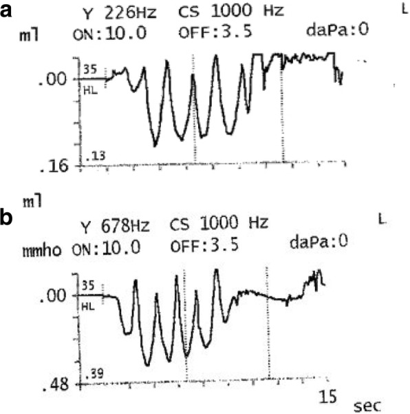 Fig.2