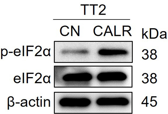 Figure 5—figure supplement 5.