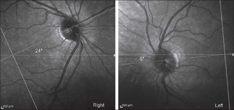 Fig 1.