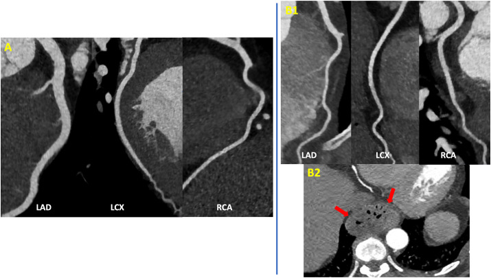 Fig. 3