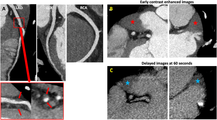 Fig. 6