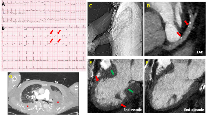 Fig. 1