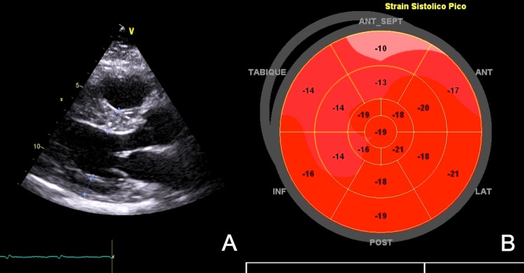 Figure 2